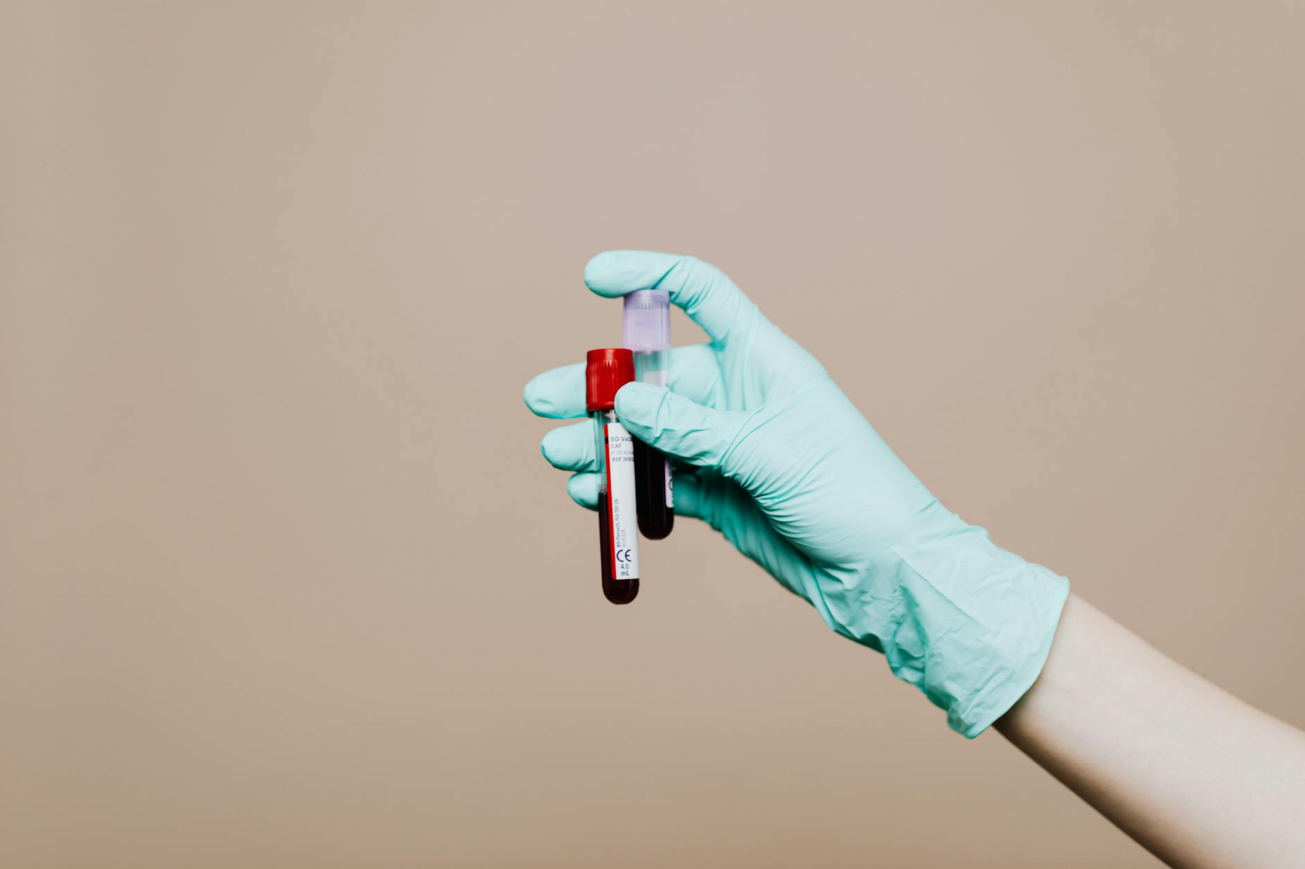 How Often Should You Test Progesterone Levels in Dogs? Accurate hormone timing leads to healthier litters and simplified fertility planning.