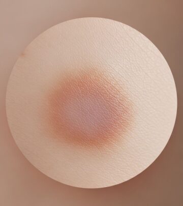 Explore the facts, common causes, and safe remedies for dark vaginal skin discoloration, helping you care for your intimate skin confidently.
