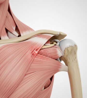 Explore the essential facts about rotator cuff tendinitis, including its causes, symptoms, diagnosis, management, and recovery strategies.