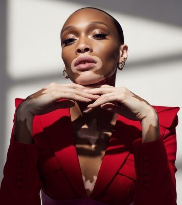 How model Winnie Harlow challenges beauty norms and inspires confidence through her journey in the fashion world.